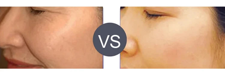 ECO CREST - Microcurrent Facial Lifting & Sculpting Massager