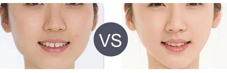 ECO CREST - Microcurrent Facial Lifting & Sculpting Massager