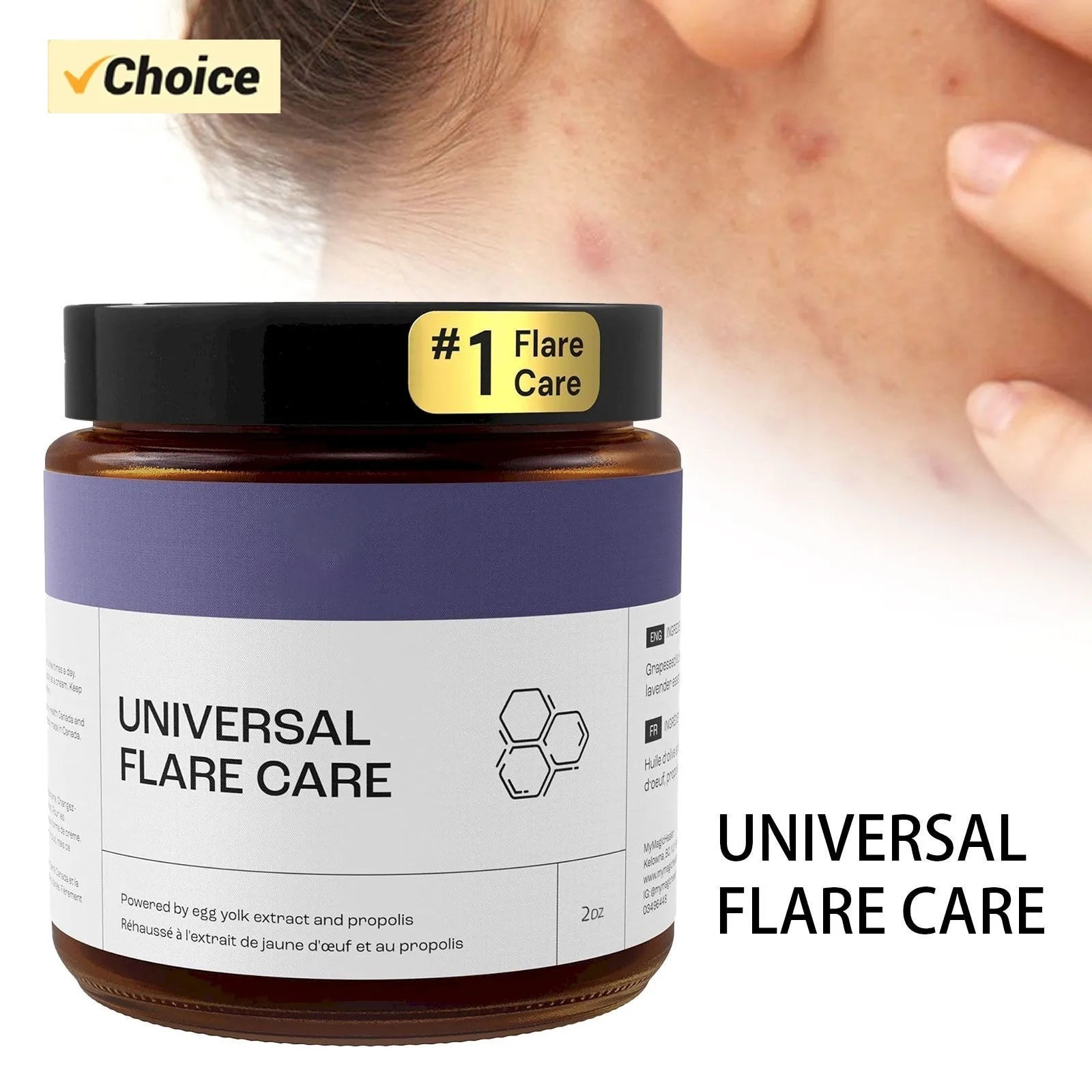 U Niversal | R Elieve Skin Problems | Hidradenitis Suppurativa Abscesses | Solution With And Egg Yolk Extracts 1.8 Oz